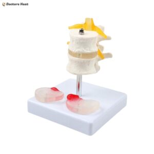 Alternative view of Lumbar Intervertebral Spine Model | Herniated Disc Anatomy Model