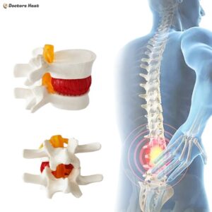 Intervertebral Disc Anatomy Model