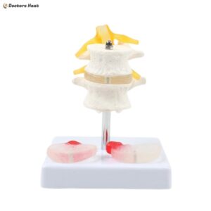 Lumbar Intervertebral Spine Model